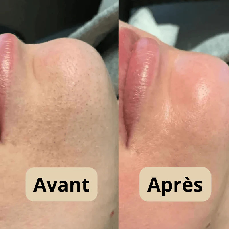 Nuvia™ | Peeling illuminateur