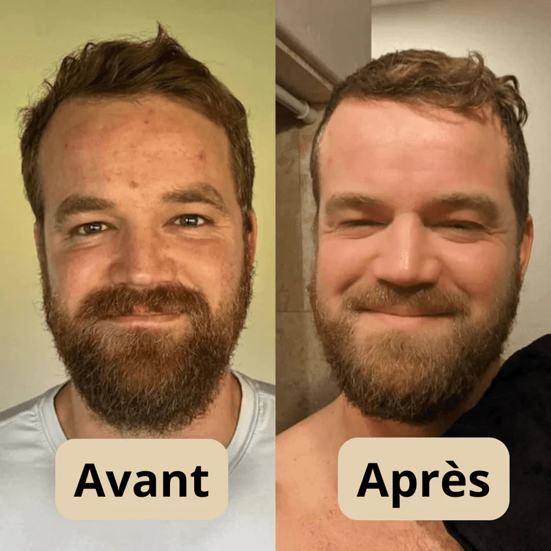 Nuvia™ | Peeling illuminateur