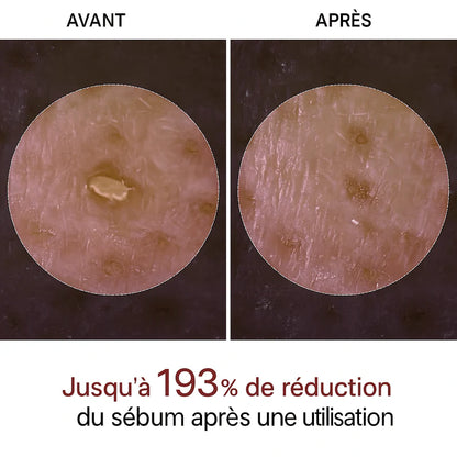 Nuvia™ | Peeling illuminateur